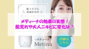 メティーナの効果の実態!肌荒れや大人ニキビに変化は?